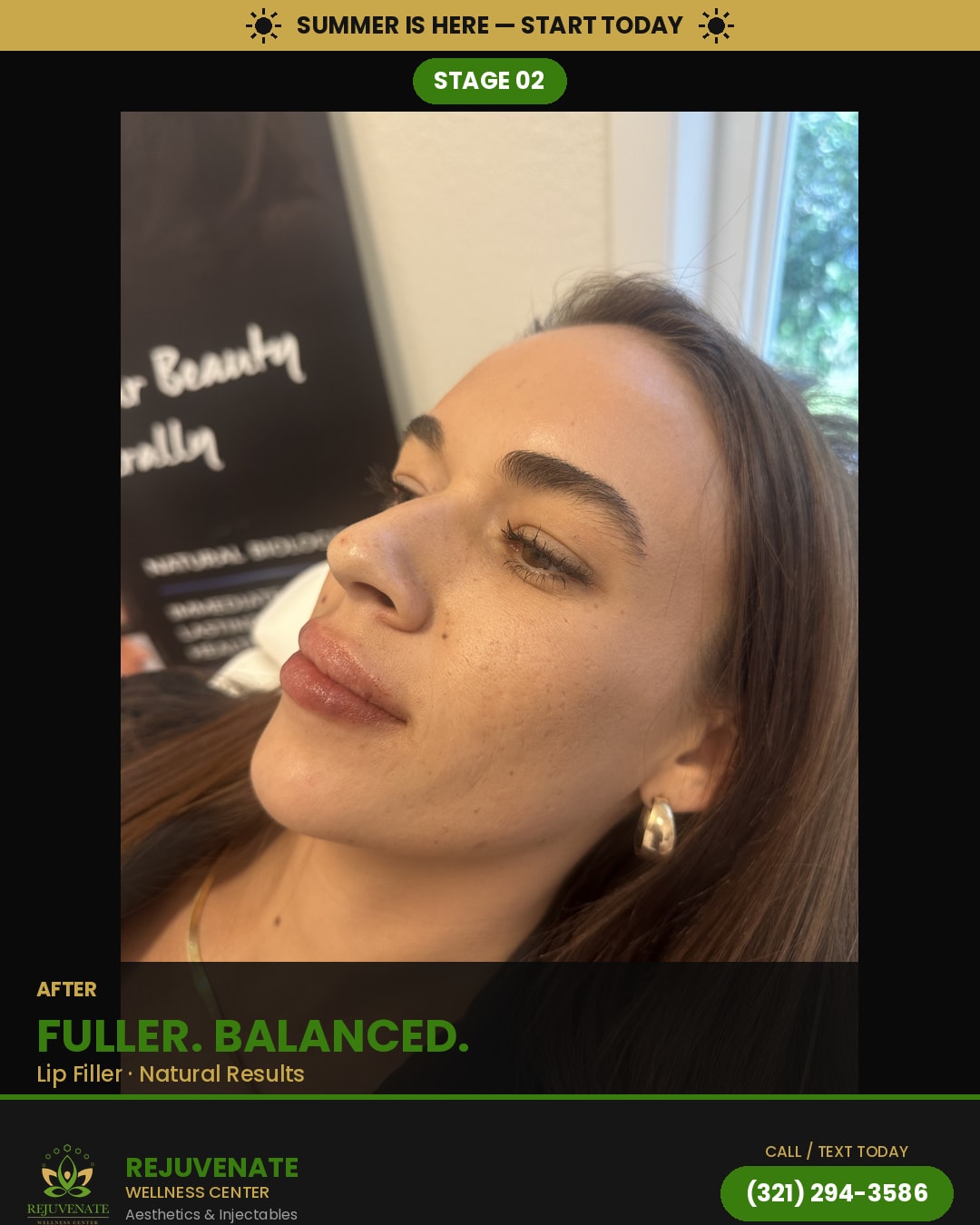 After — Fuller. Balanced.