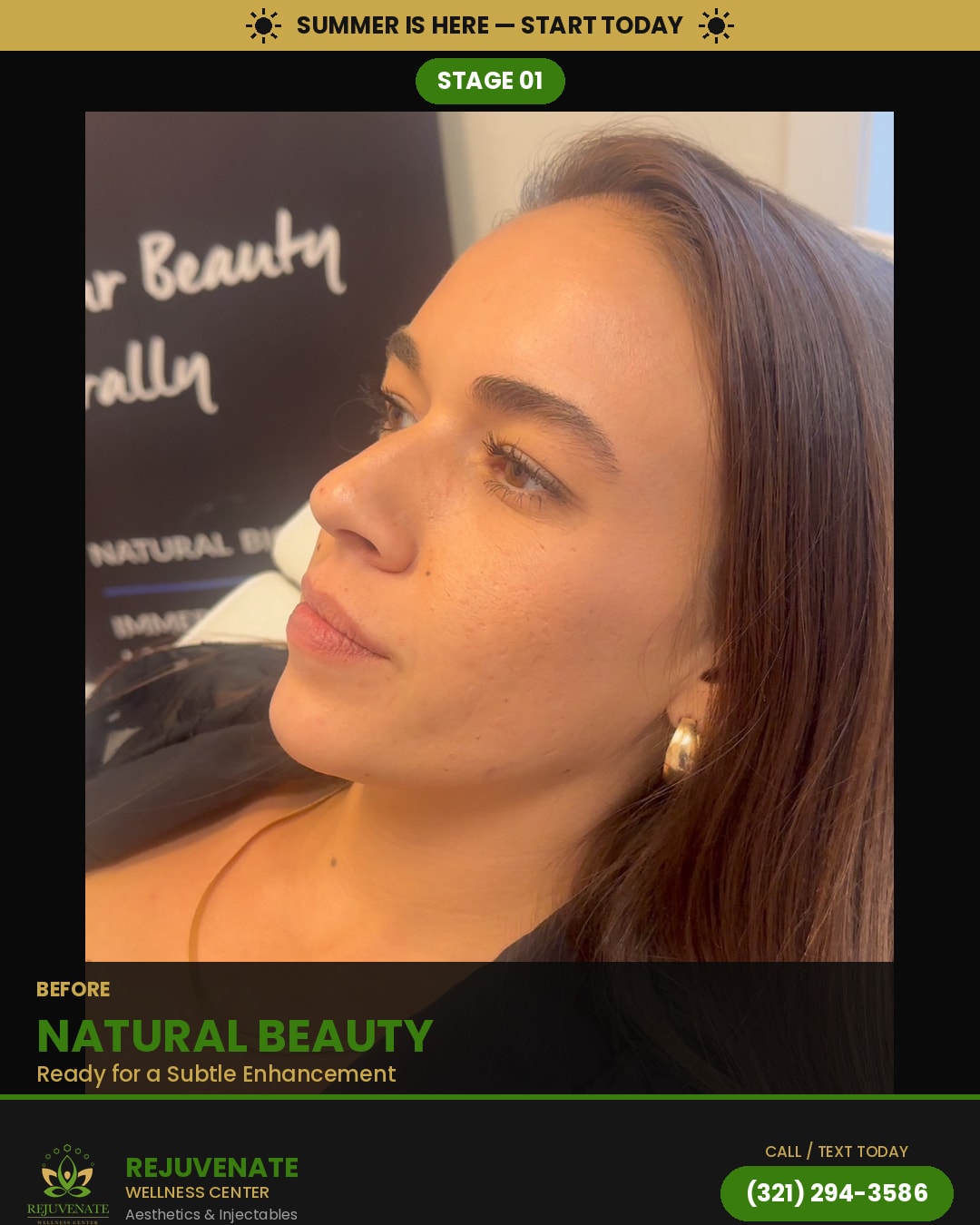 Before — Natural Beauty