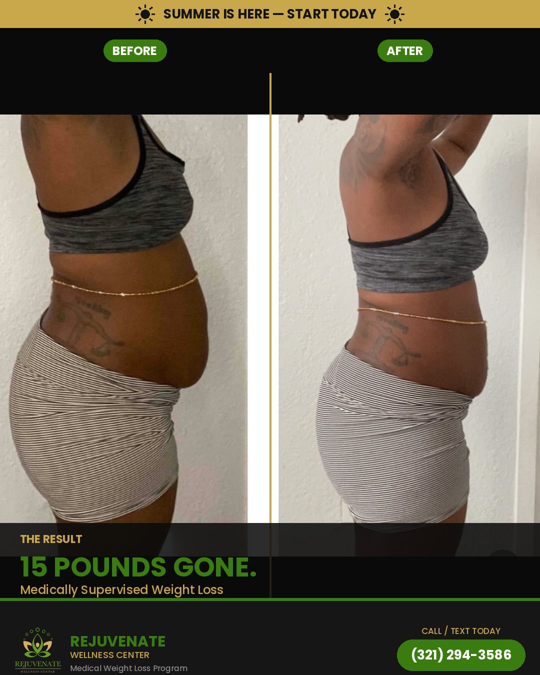 BEFORE — 15 Pounds Gone.