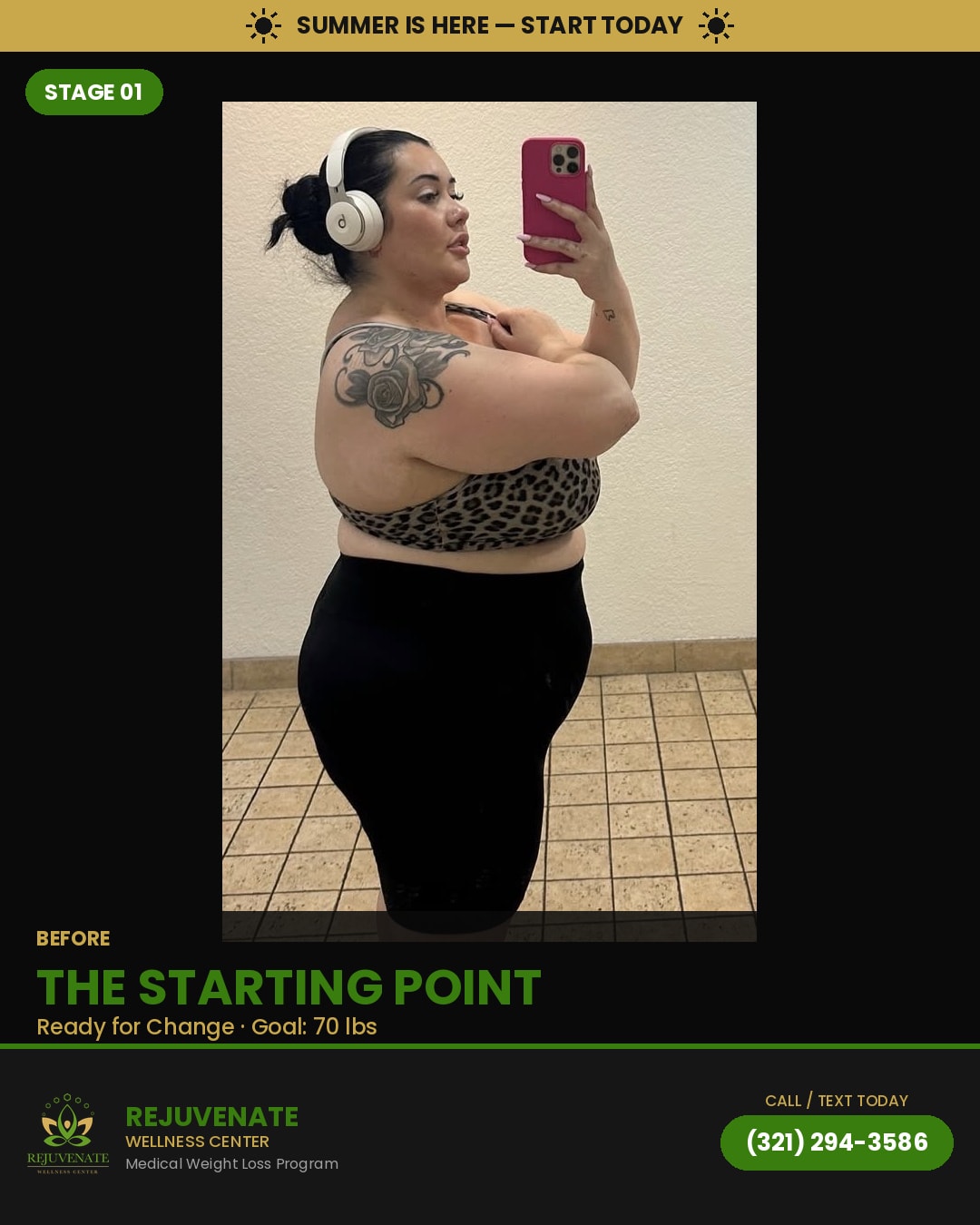 Patient before medical weight loss — Rejuvenate & Wellness Center Orlando