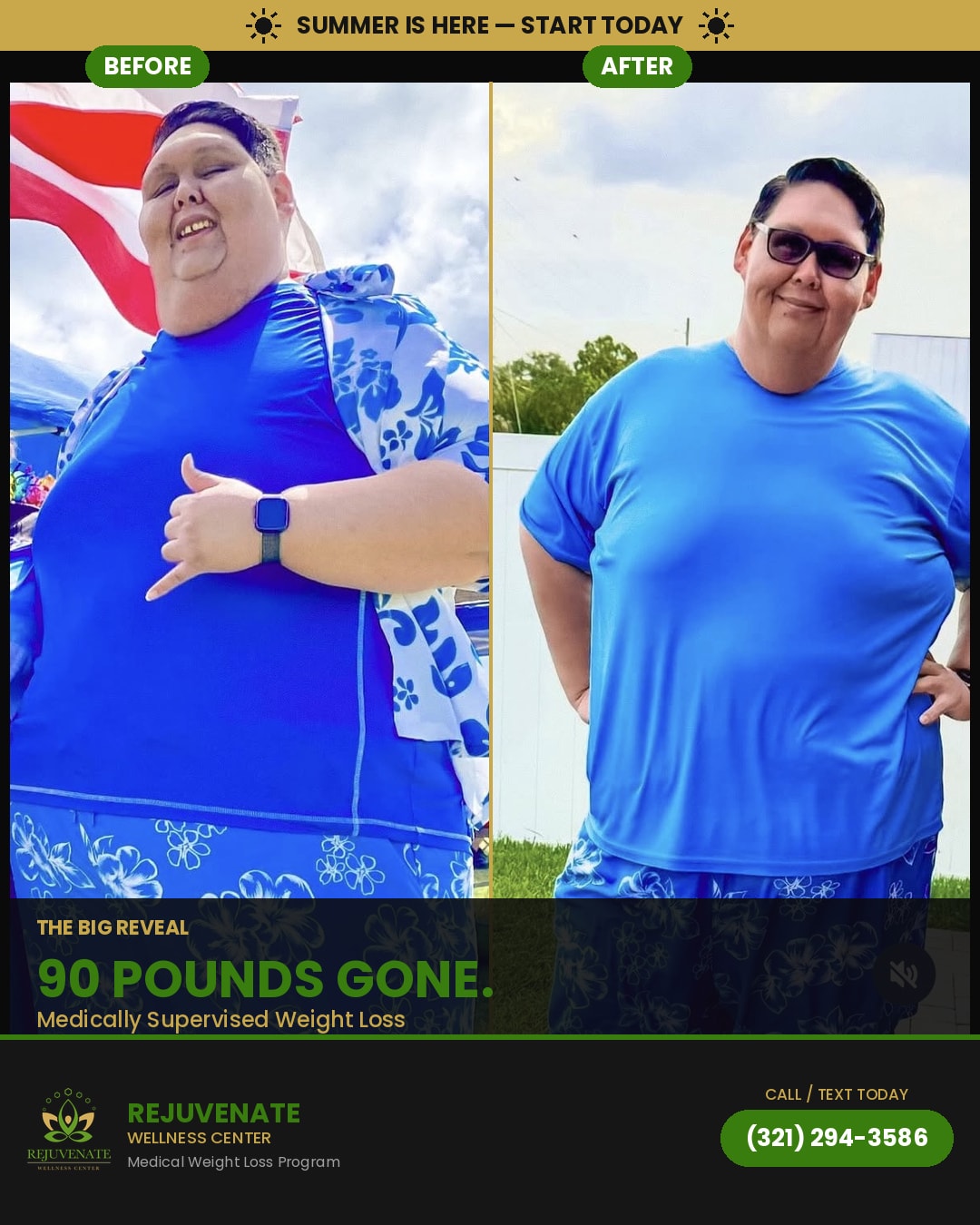 BEFORE — 90 Pounds Gone.